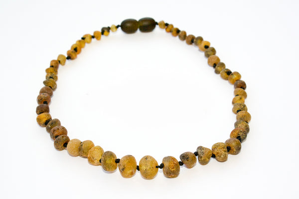 HEALING AMBER - NATURE'S PAIN REMEDY